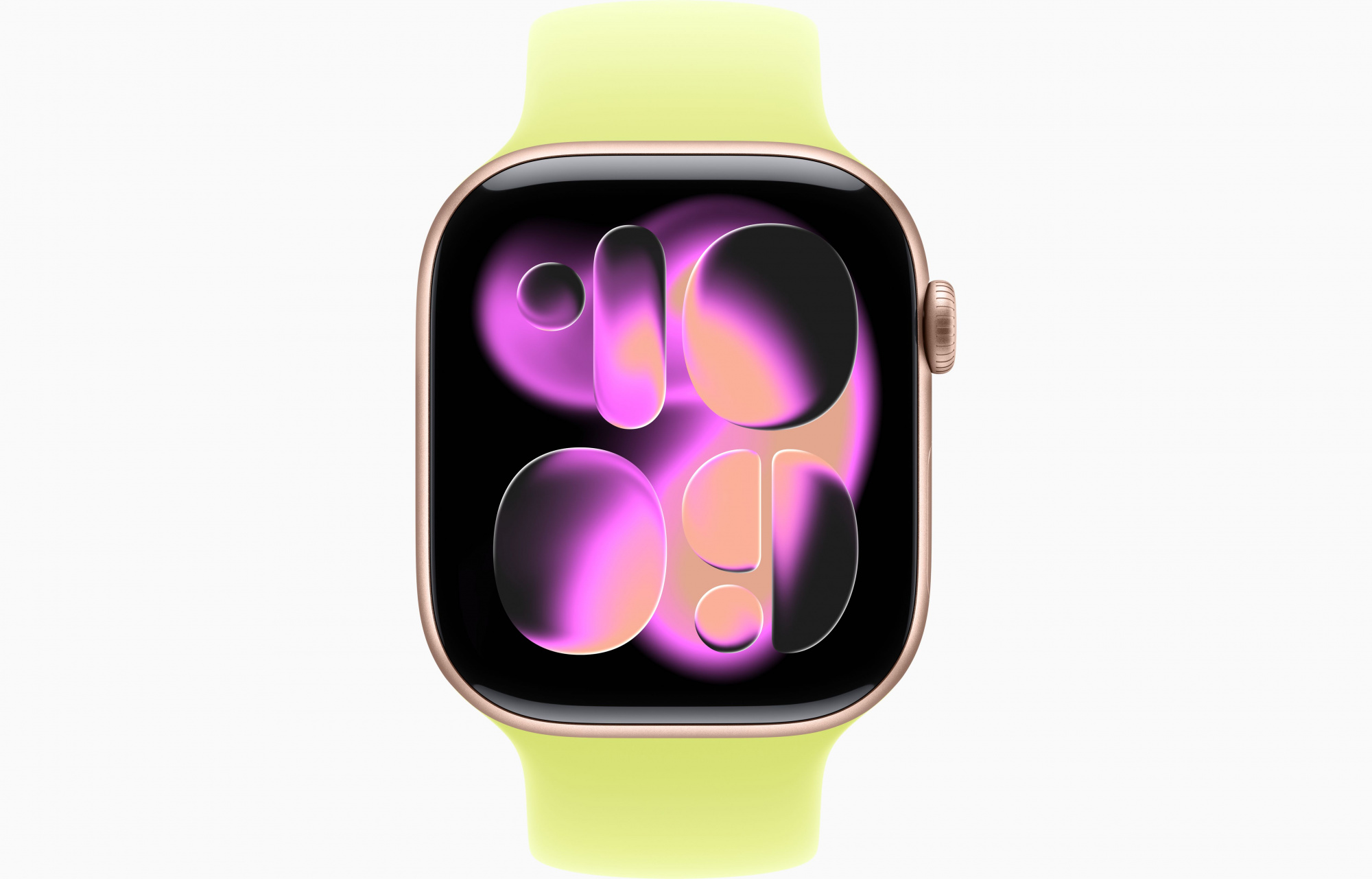 Neon Yellow2